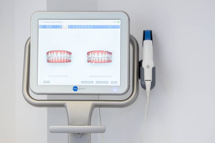 i-Tero Intraoralscanner